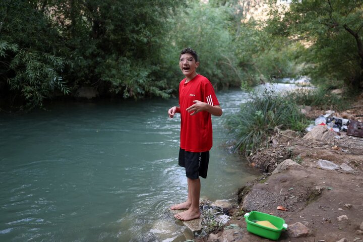 گزارش تصویری/ نوجوان لبنانی دو سال پس از انفجار پیجرها