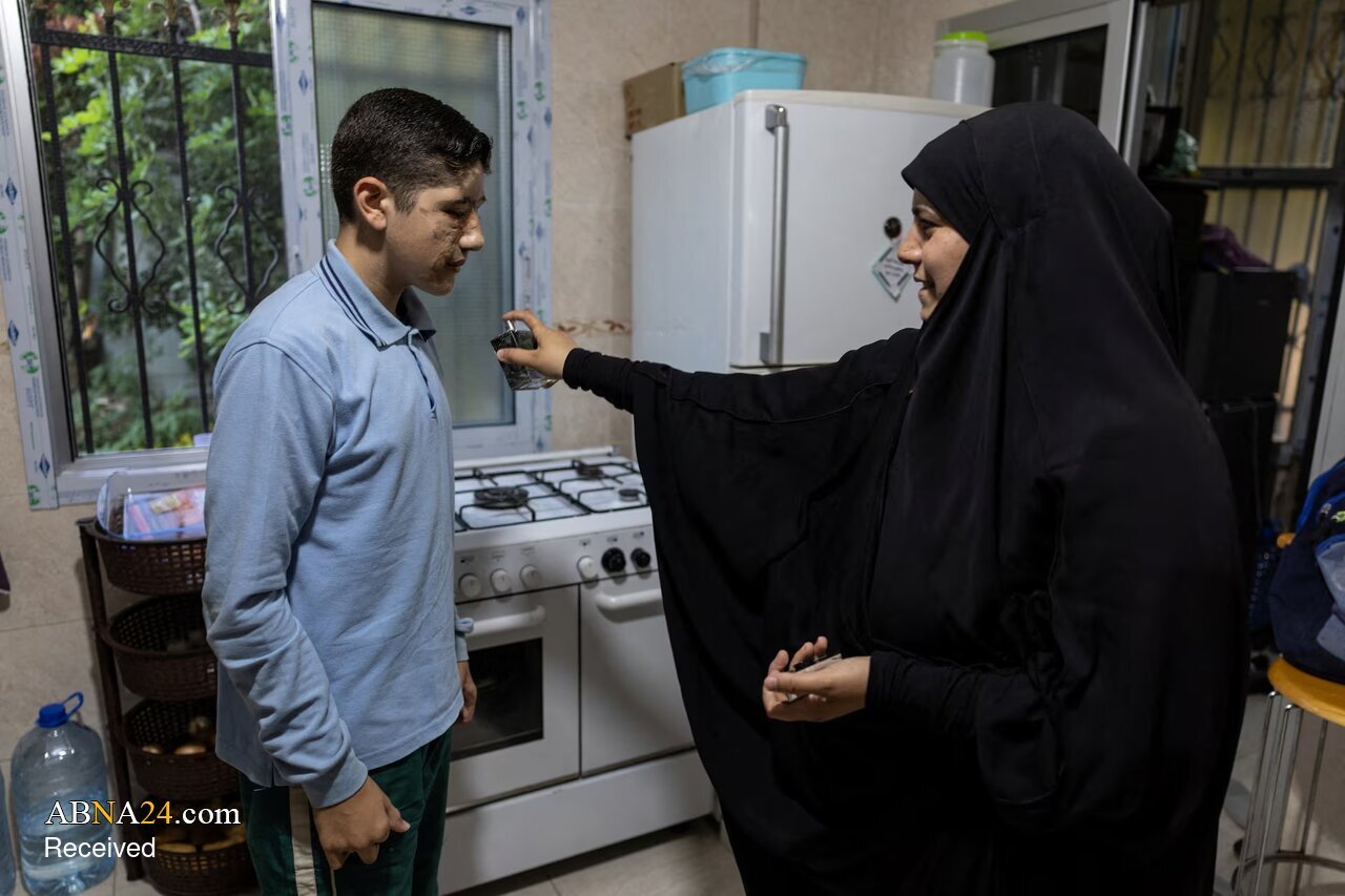 Foto / 14 yaşındaki Ali Abbas; Lübnan’daki çağrı cihazı patlamalarından iki yıl sonra
