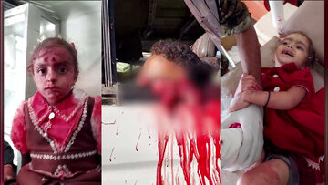 وزارة الصحة اليمنية تعلن عن عدد الشهداء وجرحى العدوان السعودي الغاشم