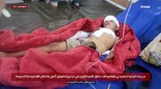 یمن: ذمار میں سعودی حملے کے نتیجے میں شہداء اور زخمیوں کی تعداد 20 ہوگئی