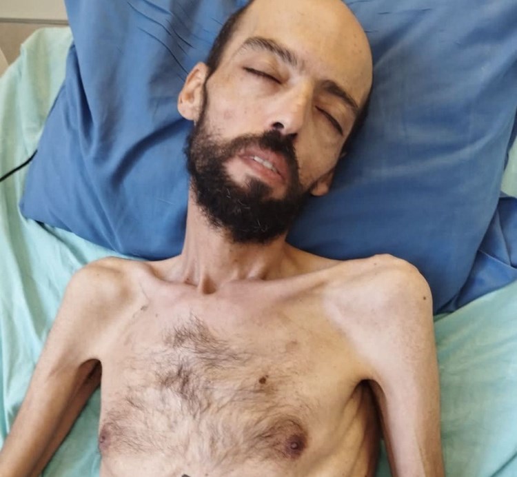 صور مروعة للأسير عواودة: يواجه خطر الموت في أيّ لحظة