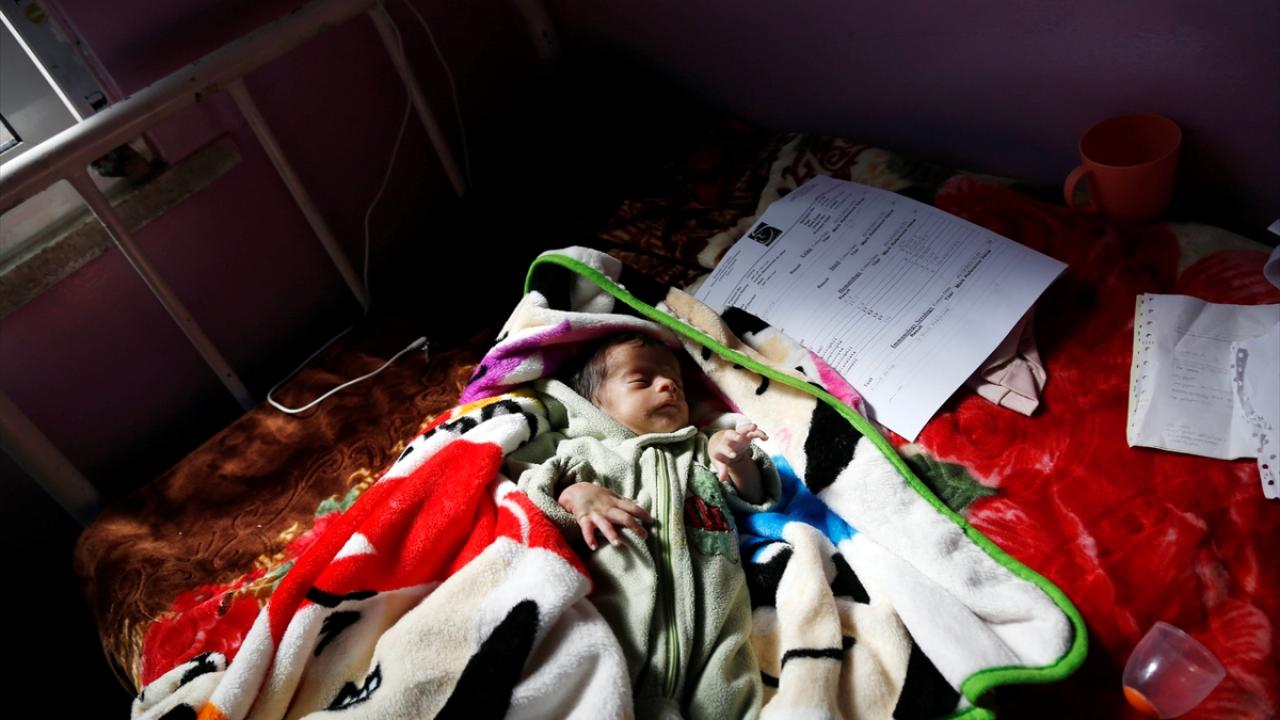 جان نیم میلیون کودک در یمن به دلیل سوءتغذیه در خطر است + تصاویر