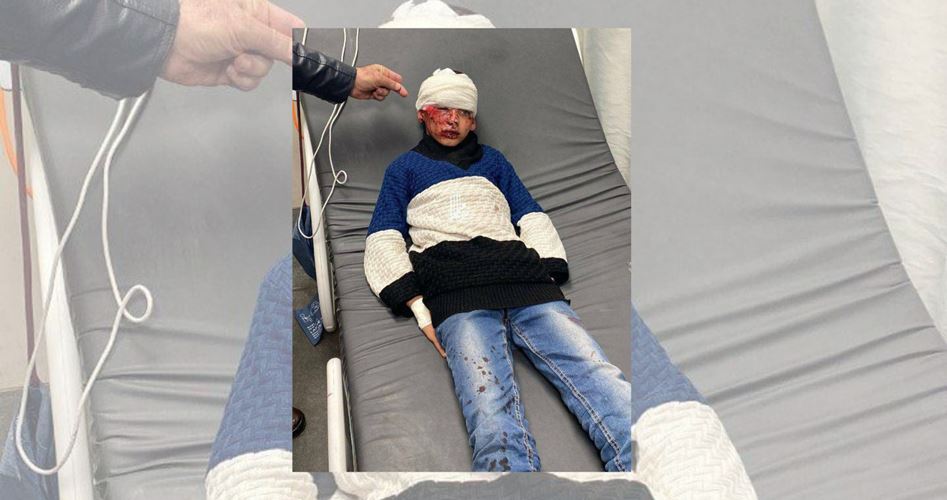 Three Palestinian children assaulted on "World Children's Day"