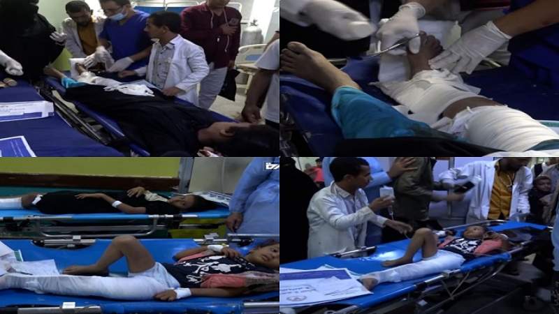 الحديدة.. إصابة 12 مواطناً بينهم 6 أطفال بانفجار ألغام من مخلفات العدوان
