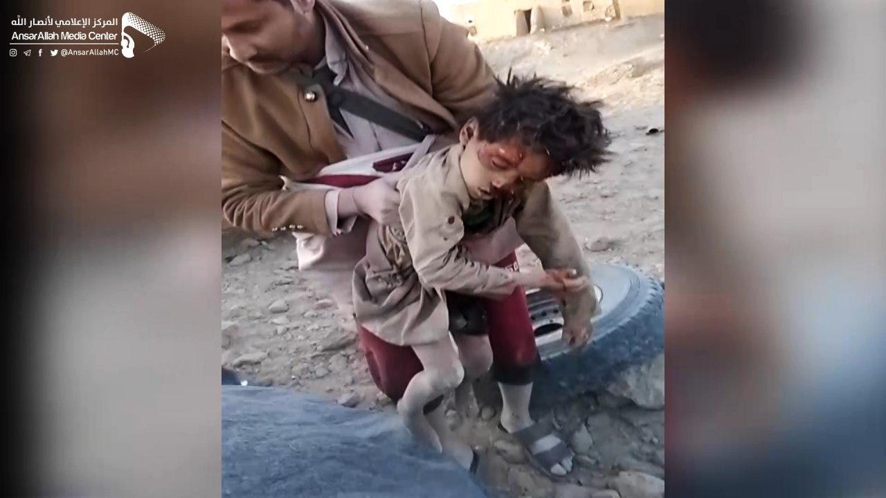 سقوط 4017 شهيداً و4588 جريحاً من الأطفال في اليمن   
