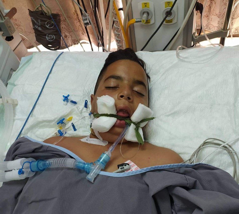  Palestinian boy martyred by Israeli terrorist troops in WB 