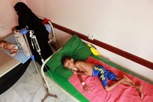   تراژدی مرگ کودکان یمنی بر اثر داروهای آلوده