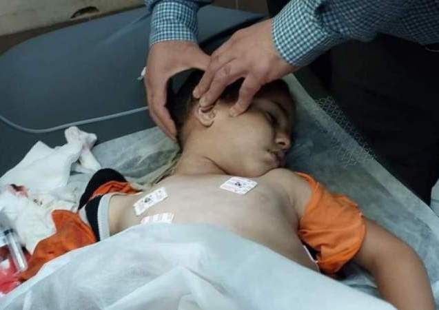  استشهاد طفل فلسطيني خلال ملاحقة قوات العدو لطلبة المدارس جنوب بيت لحم