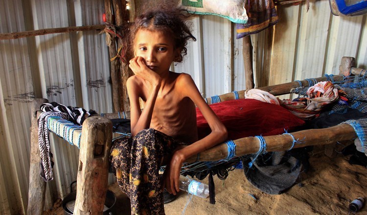 تفاقم أزمات اليمن.. "الأغذية العالمي" يقلص مساعداته بسبب نقص التمويل