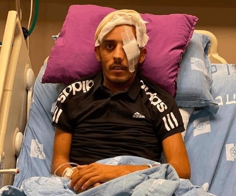 استشهاد شاب فلسطيني متأثرًا بحراجه برصاص الاحتلال الصهيوني في القدس