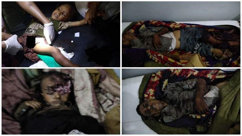 شهداء وجرحى بينهم أطفال بقصف مدفعي لمرتزقة العدوان في تعز