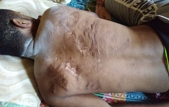 منظمة حقوقية تكشف حصيلة أبناء أبين المخفيين قسرا في سجون الانتقالي
