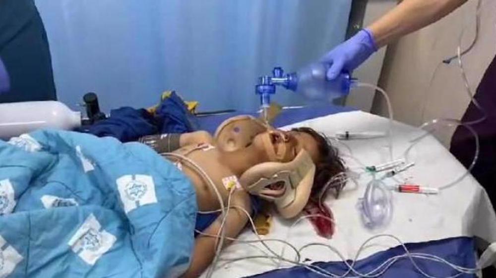 4-year-old Palestinian child in critical condition after run over by Zionist settler