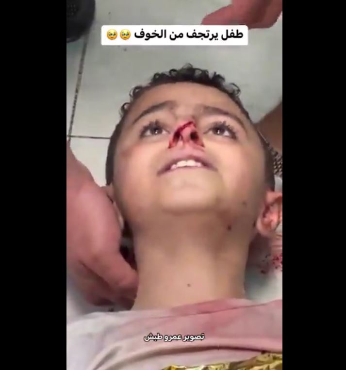Video: An injured boy goes into shock at hospital after targeted by Israeli airstrike in Gaza