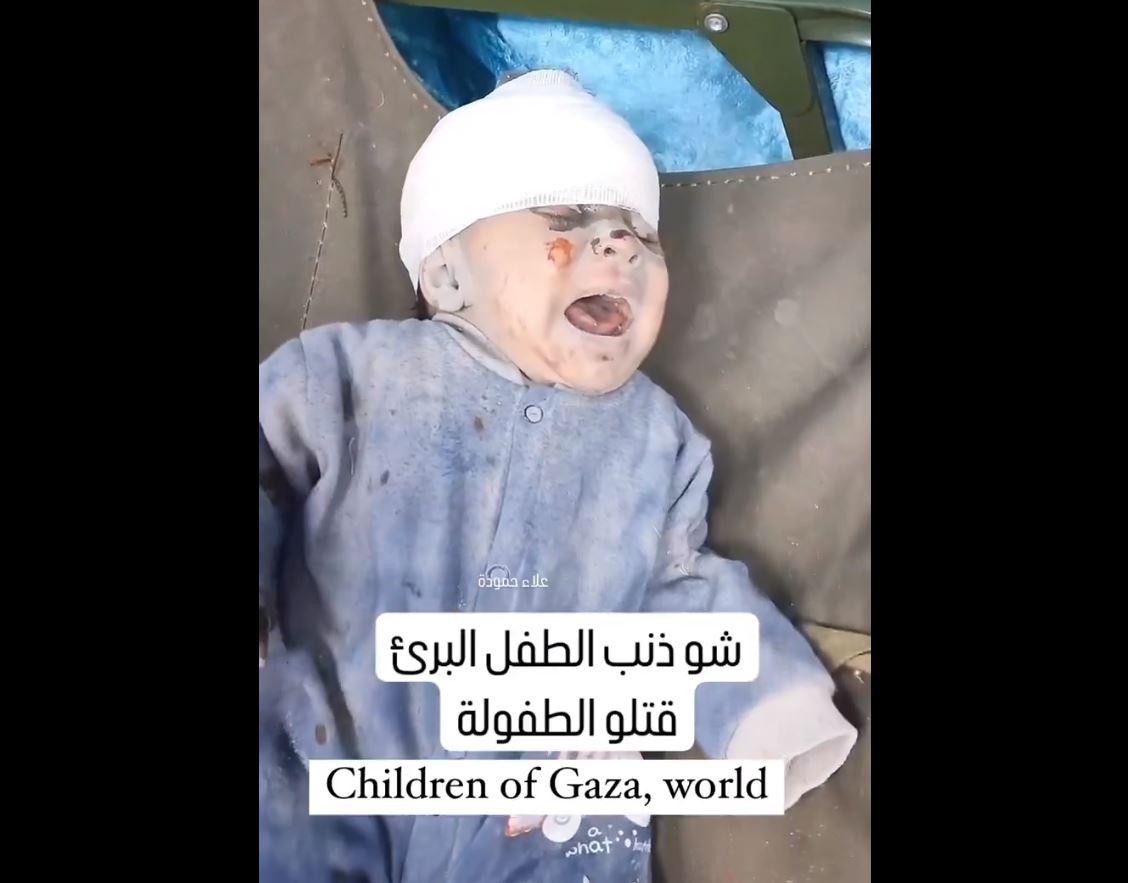 Video: Children of Gaza remain a main target of Israeli genocide campaign on its 71st day