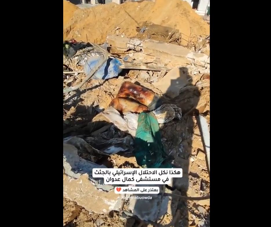 GRAPHIC: This is what Israeli occupation does in Gaza hospitals
