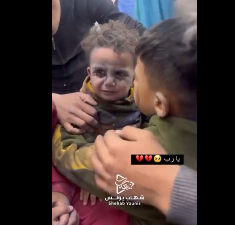 فيديو | طفل فلسطيني يحاول تهدئة أخيه الصغير أصيب في غارة للاحتلال الصهيوني