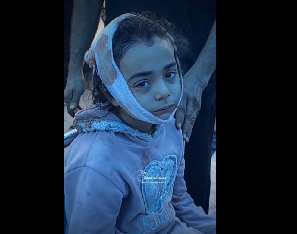 Video: Palestinian little girls suffer injuries from an Israeli airstrike in Gaza