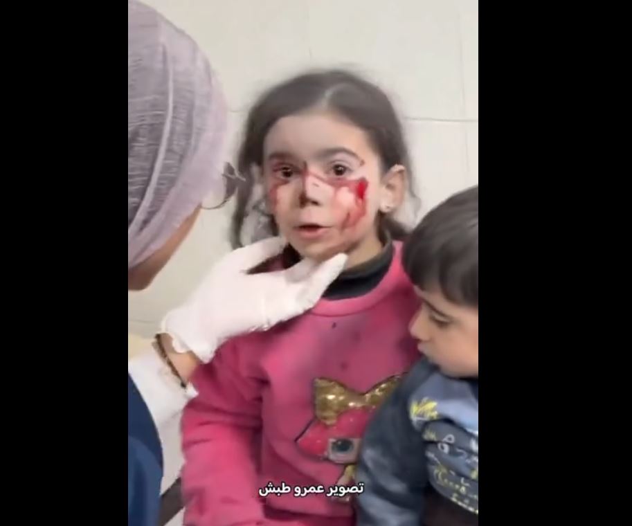 Video: Injured children under treatment after survived in Israeli airstrike in Khan-Younis