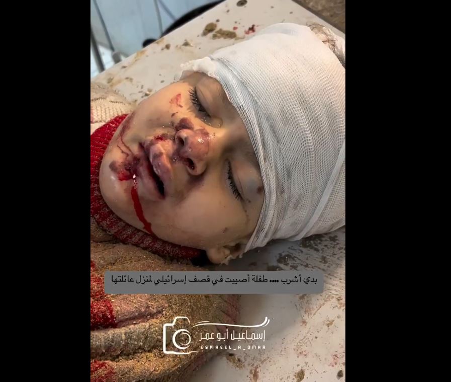 Video: All this injured Palestinian girl asks for is something to drink