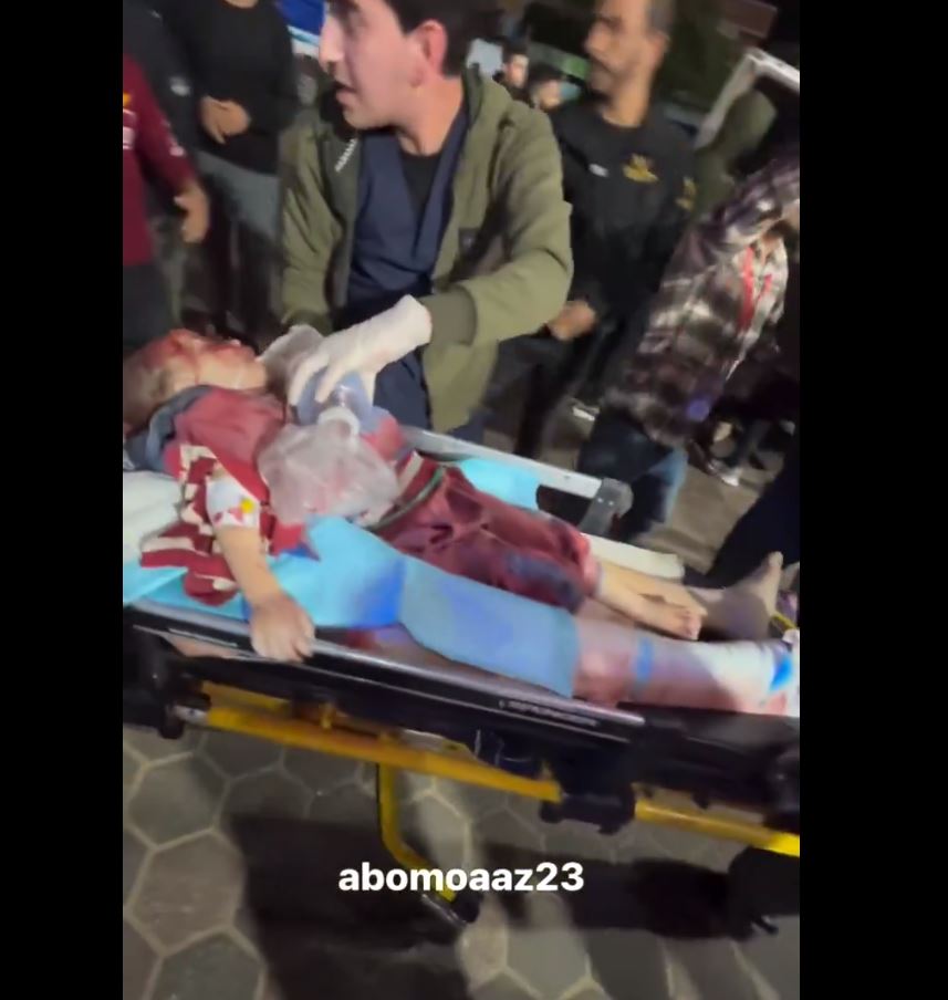 Video: These two little brothers critically injured in Israeli airstrike in Gaza last night