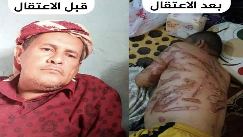  مقتل مواطن بعد اختطافه وتعذيبه بوحشية من قِبل مرتزقة العدوان في أبين 