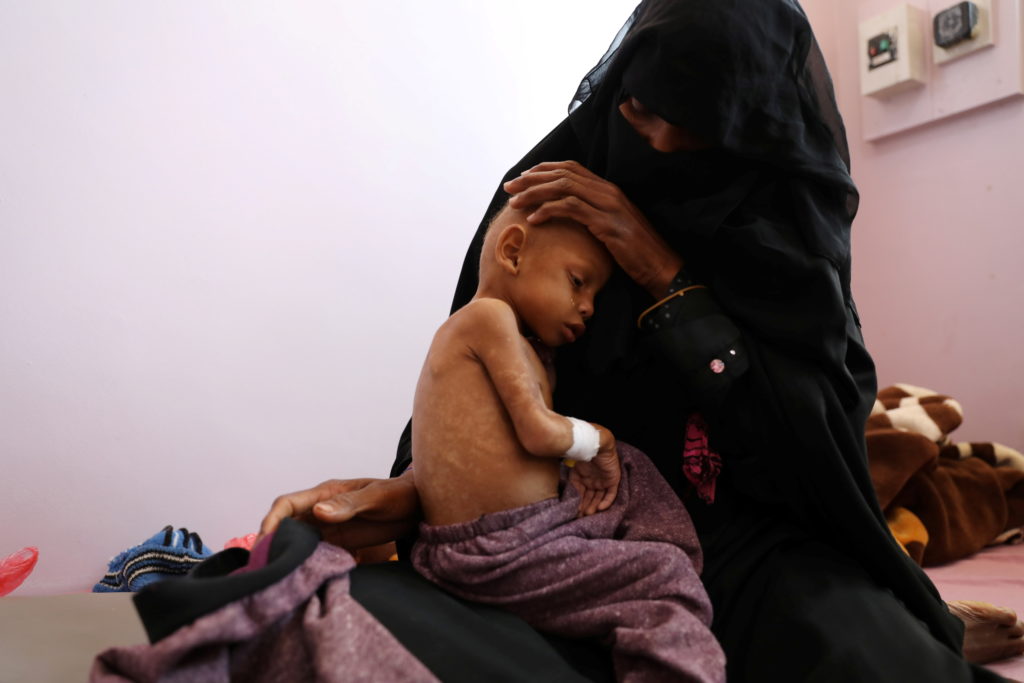 War devastated Yemen, one child dies every ten minutes: UNICEF