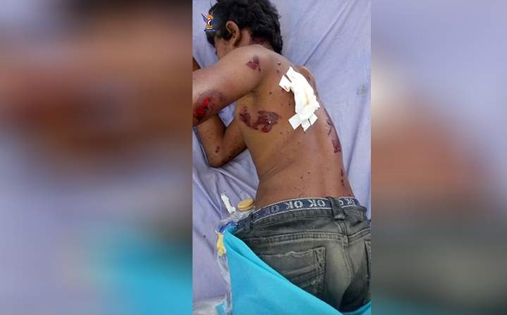 استشهاد طفل وإصابة آخر بانفجار جسم من مخلفات العدوان في الحديدة