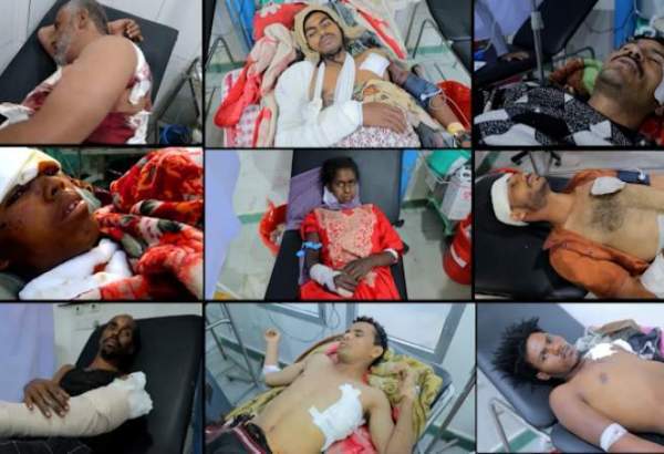 ۱۴۹ کشته و مجروح یمنی در اثر بمباران سعودی در دو ماه گذشته