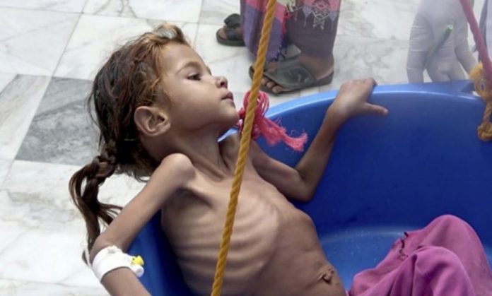 UNICEF: Nearly six million children in Yemen are one step away from starvation
