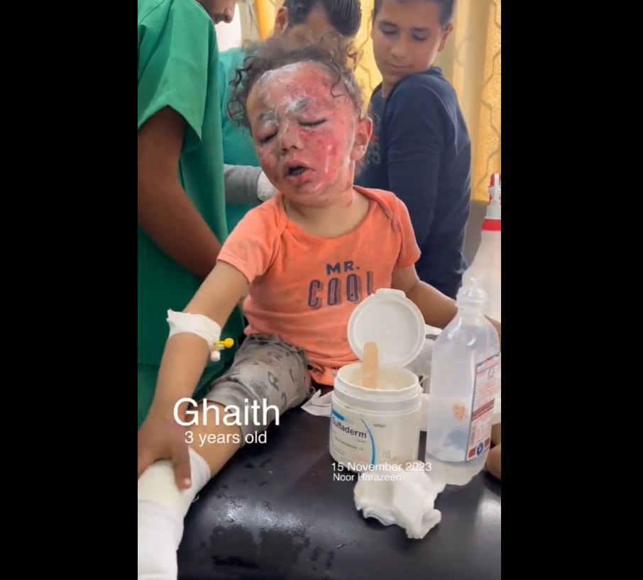 Video: Suffering of innocent Palestinian children amid ongoing Israeli genocide campaign in Gaza