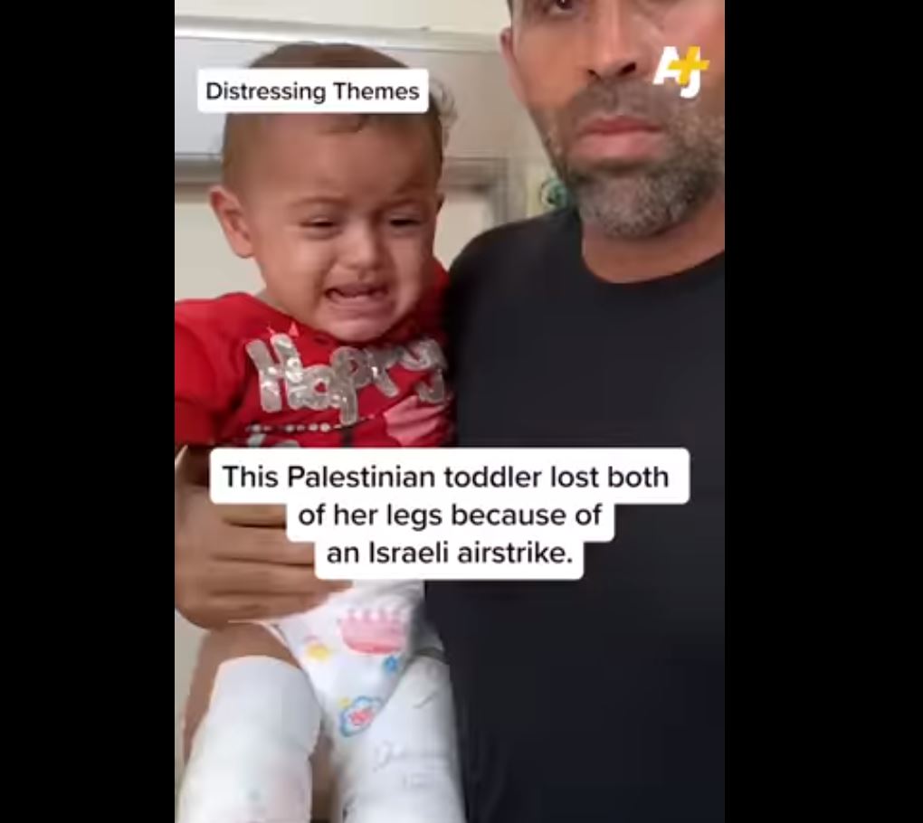 Video: Palestinian toddler lost both her legs in Israeli bombardment of Gaza