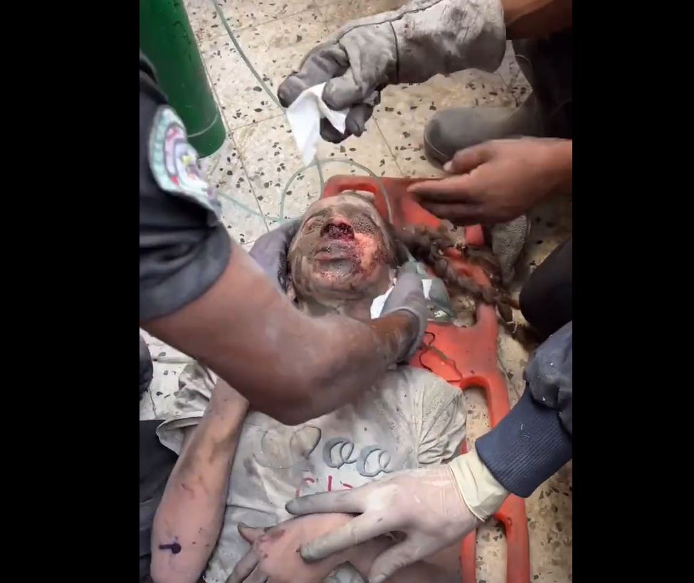 Video: This girl pulled out alive from rubble today in Gaza as Israeli genocide enters its 46th day