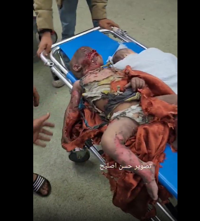 Graphic: Casualties in Israeli shelling on residential apartment in Khan Younis, S Gaza