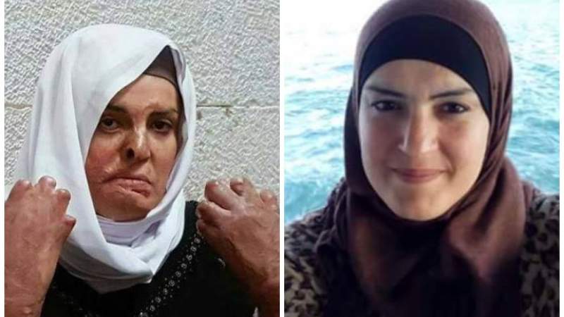  أحرقها الاحتلال.. من هي الأسيرة الفلسطينية المحررة إسراء جعابيص