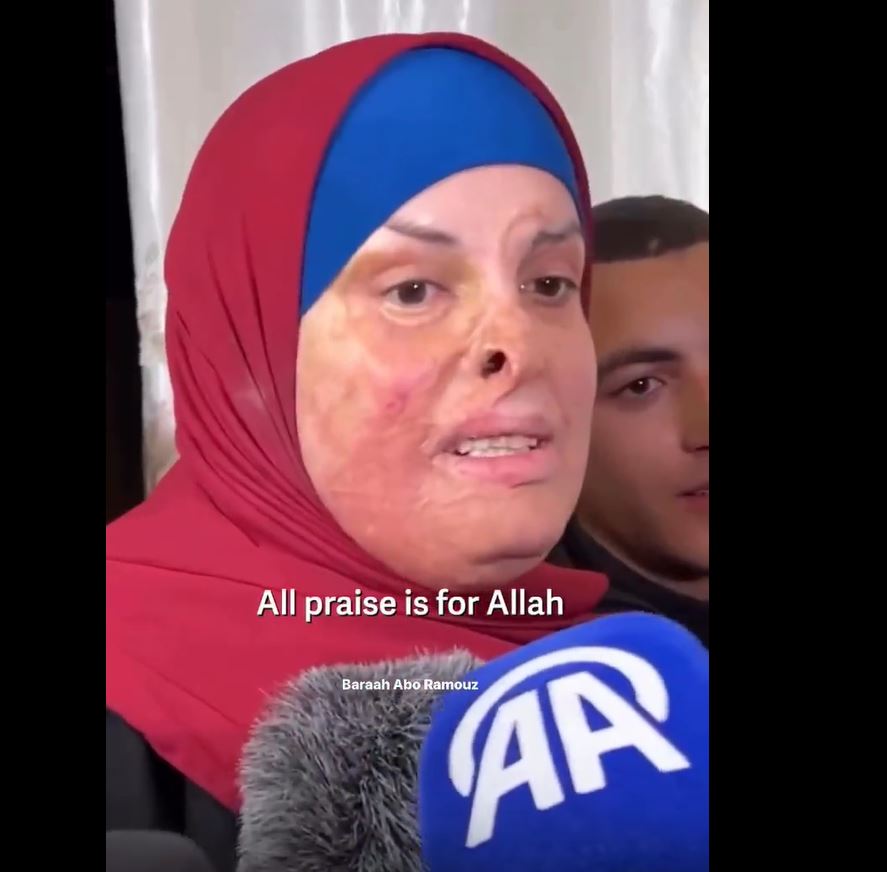 Video: Freed injured Palestinian prisoner 'Israa Al-Jaabis' speaks for first time since her release 