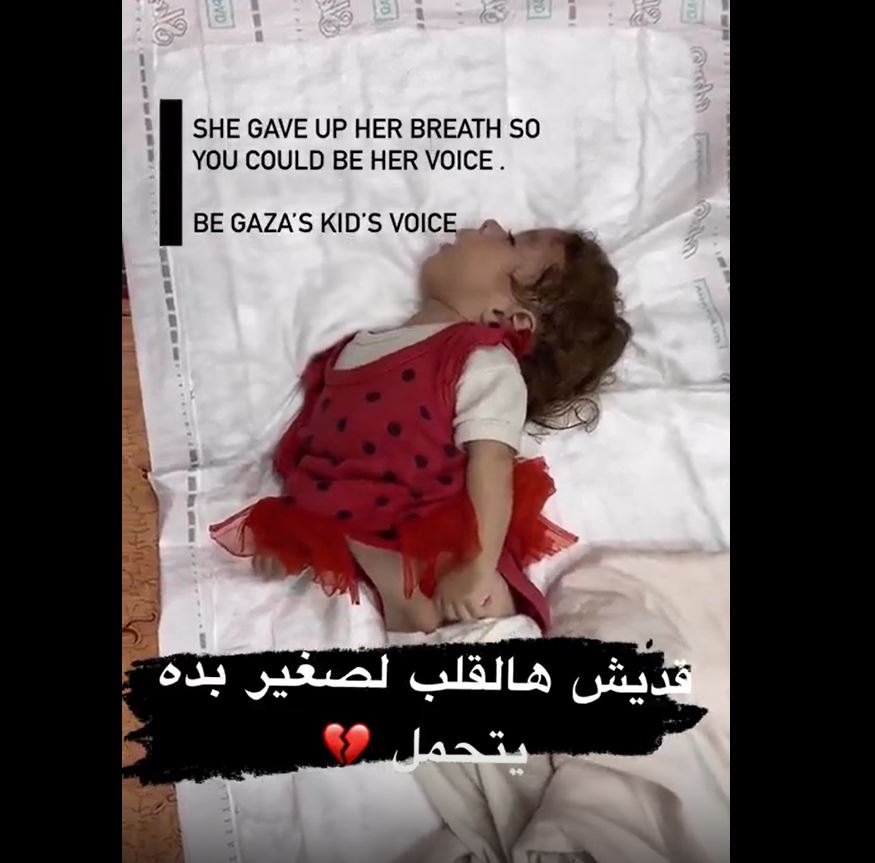 Video: Heartbreaking scene of Palestinian baby that doctors give up hope on her