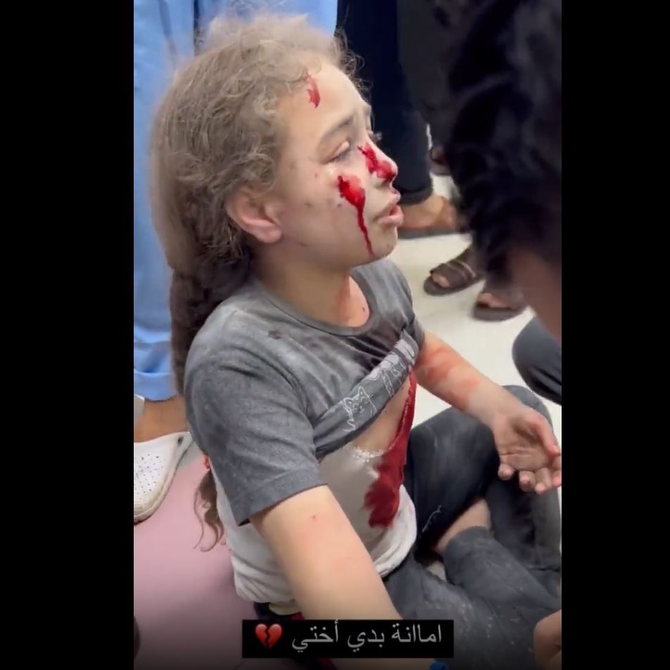 Injured Palestinian girl in Israeli bombardment: "I'm fine, just leave me, please find my sister"
