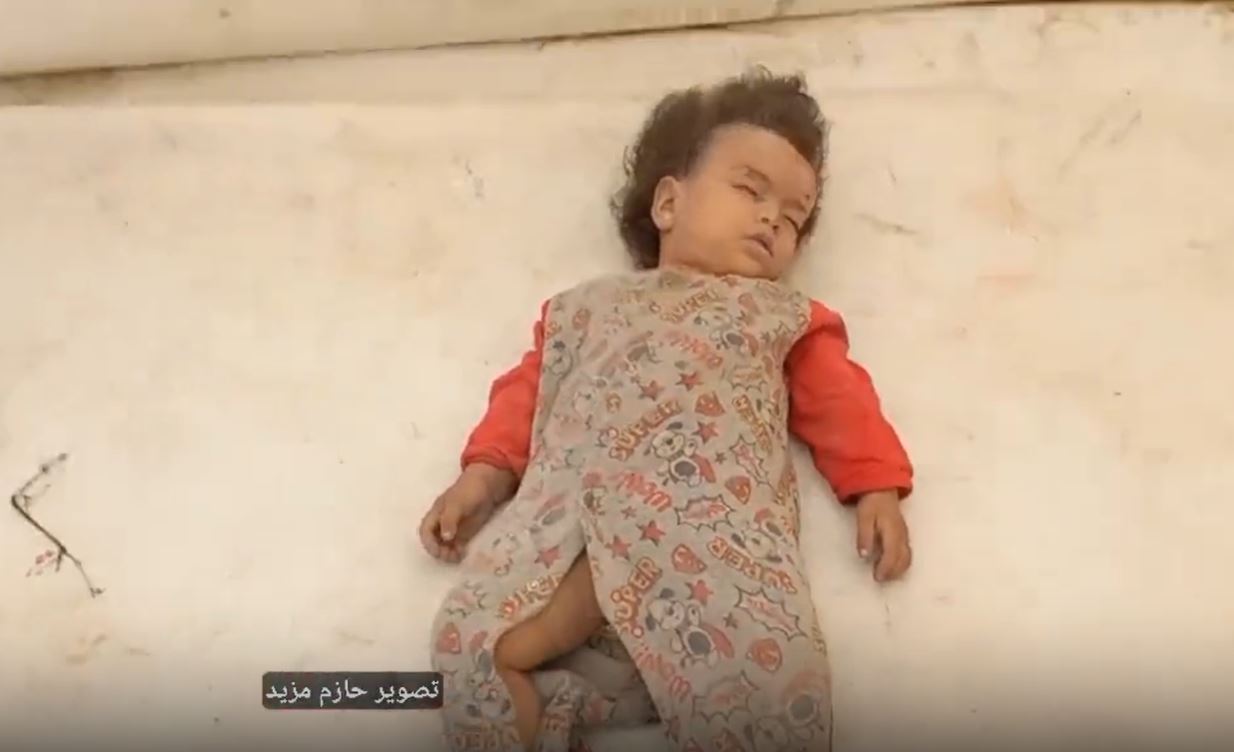فيديو / طفلة قتلتها الطائرات الحربية الصهيوني في قصف عشوائي