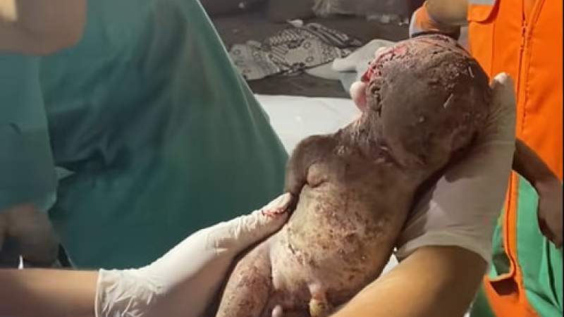  أكثر من 12500 شهيد وجريح جراء العدوان الصهيوني على الشعب الفلسطيني