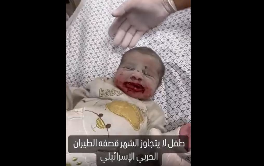 Video: Israel's targeting of babies in Gaza continues