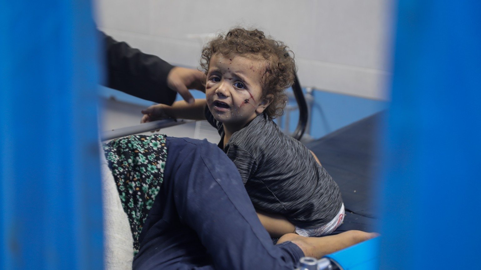 U izraelskim napadima ranjene mnoge bebe