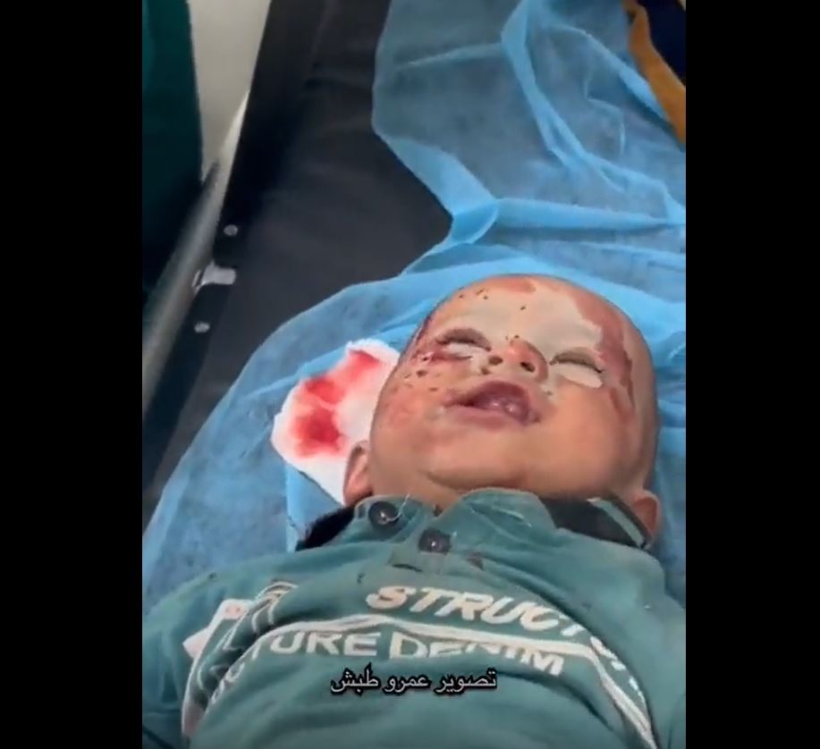 Video: Palestinian doctor calms injured little baby whose home bombed by Israeli US-made missiles