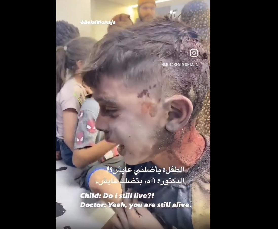 Heartbreaking Video: Injured Palestinian child ask doctor: Will I still be alive?