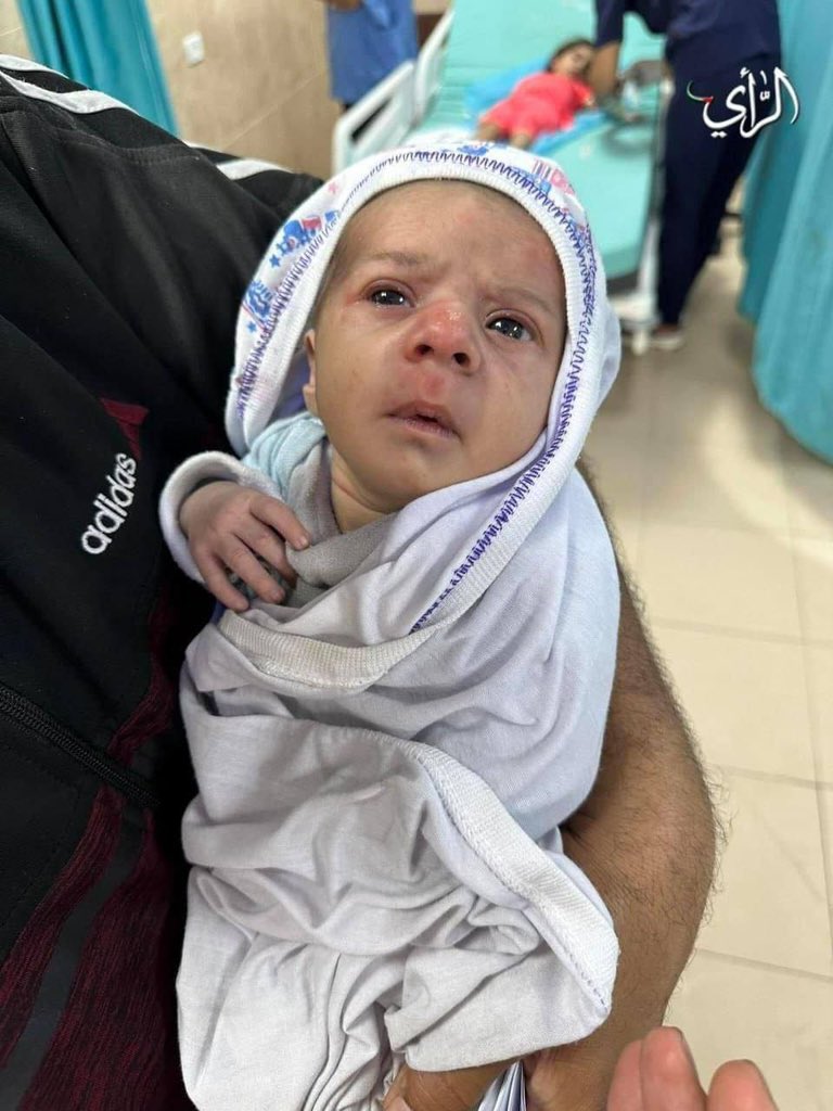 Video: Palestinian baby difficulty breathing due to inhaling dust caused by Israeli airstrike on Gaza