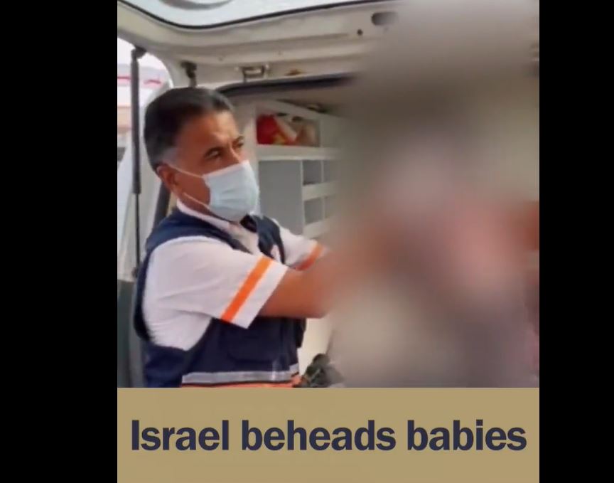 Horrible atrocities by Israeli military: This is what remained of a little girl due Gaza bombing