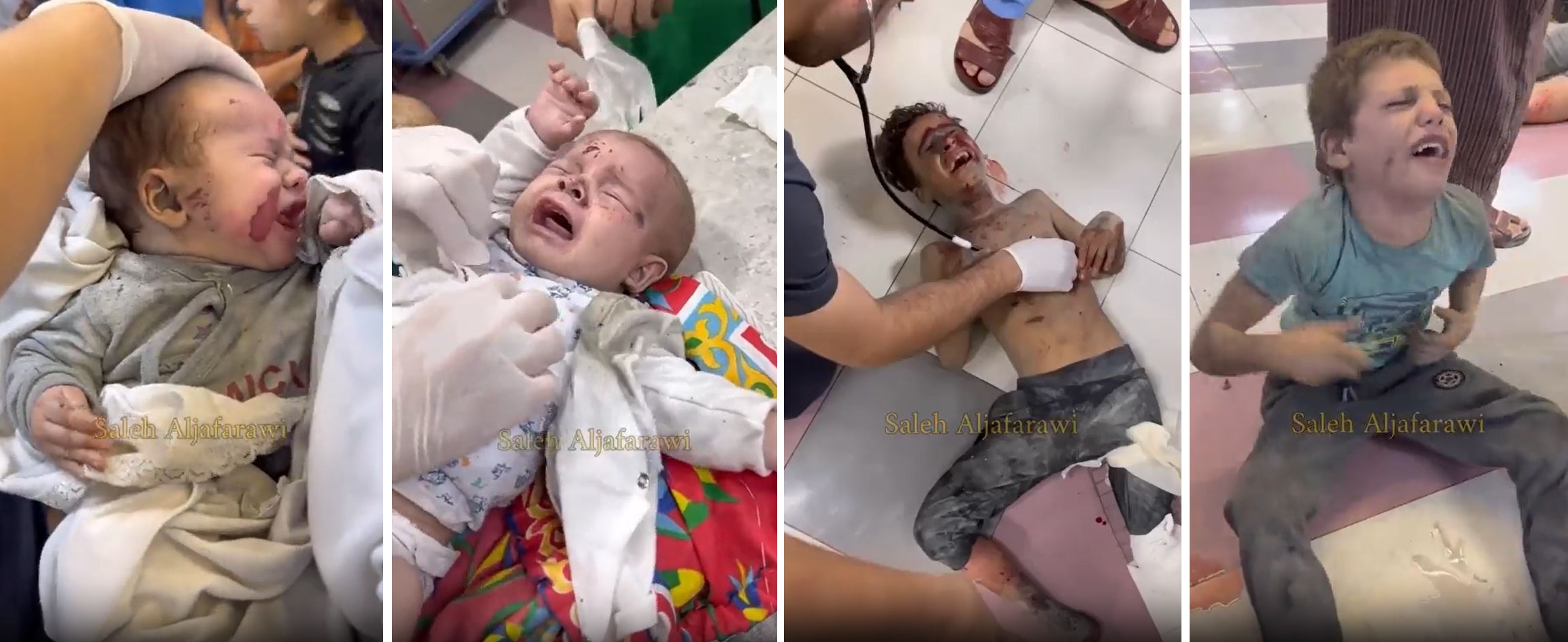 Video: With collapse of healthcare system in Gaza, this is how children being treated at hospitals...