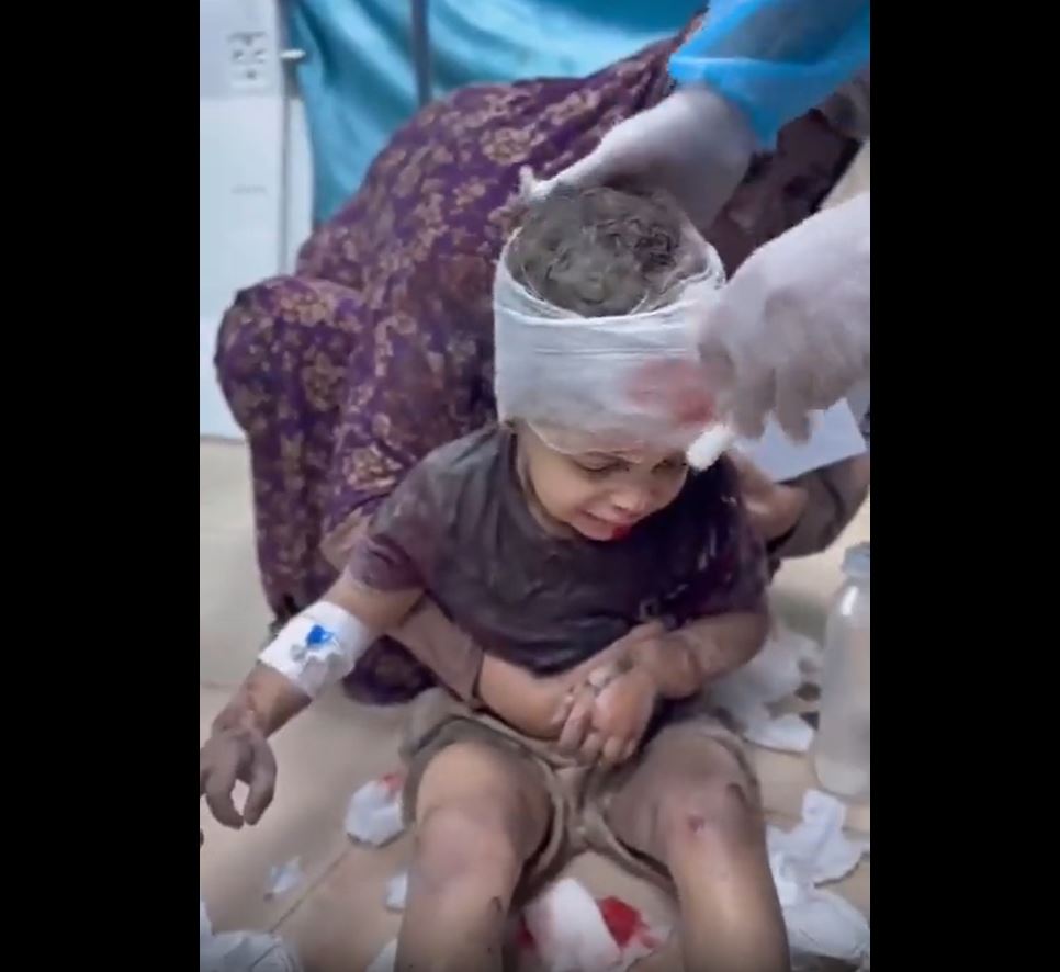 Video: While UN discussing dire situation in Gaza as health sector collapsed, no more beds left...