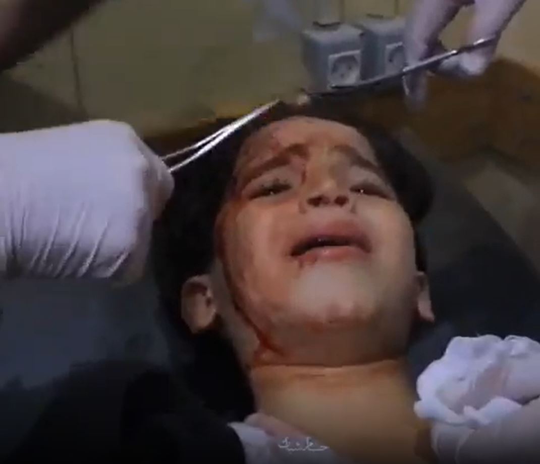Video: "Where are you, Mom?" innocent Palestinian girl screams after injured in Israeli airstrike 