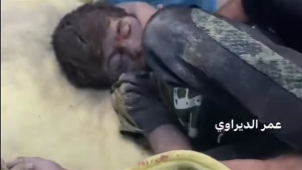 فيديو | شاهد الطفل فلسطيني الشهيد يجف جسده في حالة تحرق القلب
